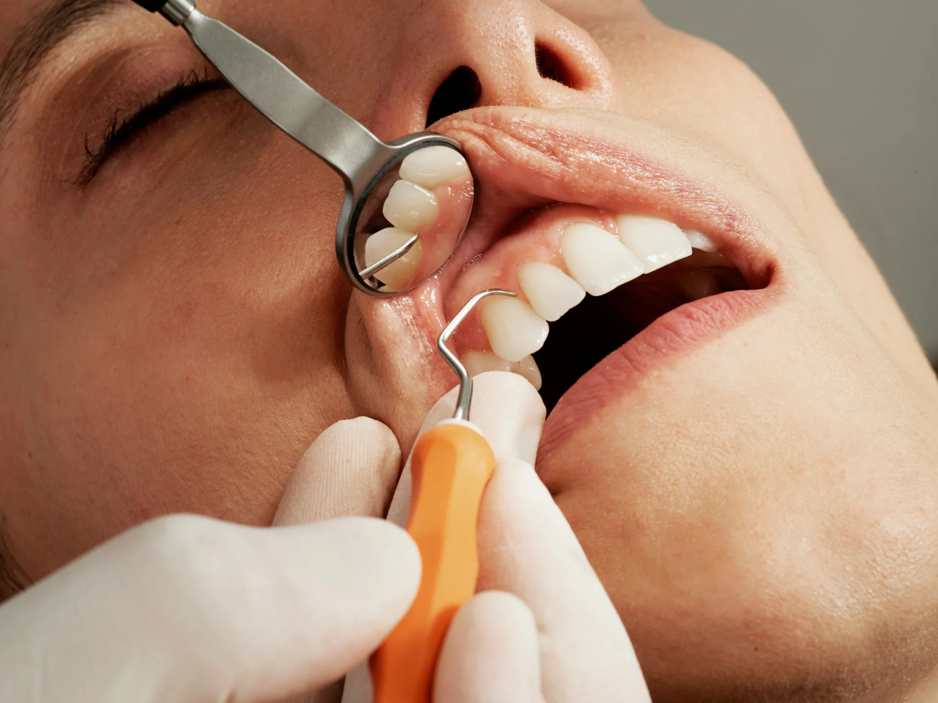 Close-up of a dental exam with a mirror and probe