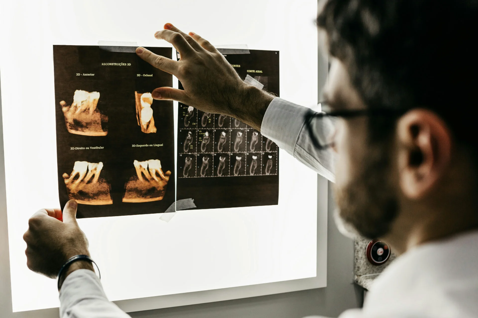 Dentist reviewing a 3D dental scan on a light box
